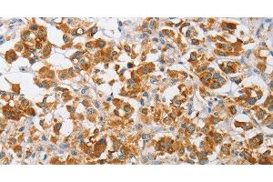 anti-Cdc42 Guanine Nucleotide Exchange Factor (GEF) 9 (Arhgef9) antibody