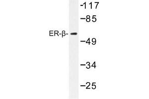 Image no. 1 for anti-Estrogen Receptor 2 (ESR2) antibody (ABIN272305) (ESR2 anticorps)
