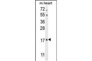 Western blot analysis in mouse heart tissue lysates (35ug/lane).