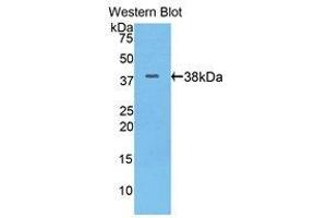 Western Blotting (WB) image for anti-Keratin 17 (KRT17) (AA 84-392) antibody (ABIN1175075) (KRT17 anticorps  (AA 84-392))