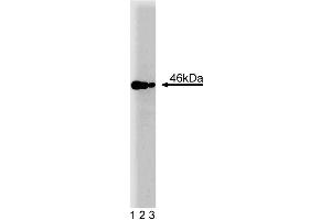 Western blot analysis of IAK1 on a Jurkat cell lysate (Human T-cell leukemia, ATCC TIB-152). (Aurora A anticorps  (AA 8-116))