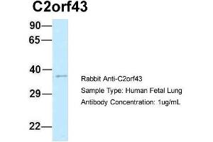 Host: Rabbit  Target Name: C2orf43  Sample Tissue: Human Fetal Lung  Antibody Dilution: 1. (LDAH/C2orf43 anticorps  (C-Term))
