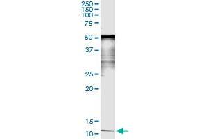 Immunoprecipitation of SAA4 transfected lysate using mouse monoclonal anti-SAA4 and Protein A Magnetic Bead (SAA4 (Humain) IP-WB Antibody Pair)