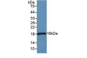 Detection of Recombinant MCP1, Rabbit using Monoclonal Antibody to Monocyte Chemotactic Protein 1 (MCP1) (CCL2 anticorps  (AA 24-125))