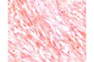 Immunohistochemistry (IHC) image for anti-Mast/stem Cell Growth Factor Receptor (KIT) (truncated) antibody (ABIN2464038)