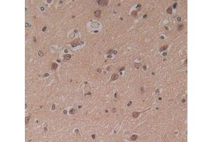 Used in DAB staining on fromalin fixed paraffin- embedded Kidney tissue (IP6K1 anticorps  (AA 1-300))