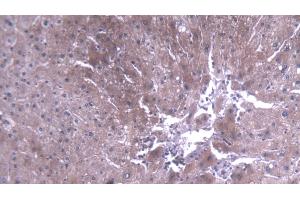 Detection of TEC in Human Liver Tissue using Polyclonal Antibody to Tec Protein Tyrosine Kinase (TEC)