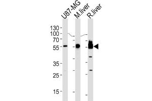 Western Blotting (WB) image for anti-3-Hydroxy-3-Methylglutaryl-CoA Synthase 1 (Soluble) (HMGCS1) antibody (ABIN3002732)