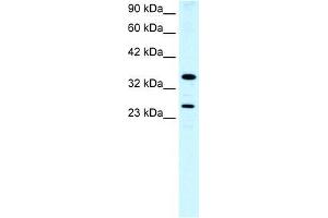 Human Lung; WB Suggested Anti-ASGR2 Antibody Titration: 0.