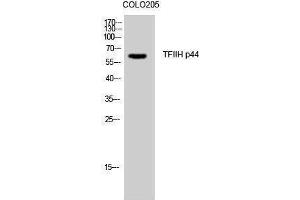 Western Blotting (WB) image for anti-General Transcription Factor IIH, Polypeptide 2, 44kDa (GTF2H2) (N-Term) antibody (ABIN3187237) (GTF2H2 anticorps  (N-Term))