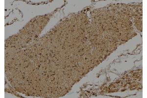 ABIN6275519 at 1/100 staining Human gastric tissue by IHC-P.