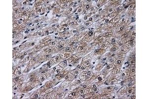 Immunohistochemical staining of paraffin-embedded liver tissue using anti-KIAA1609 mouse monoclonal antibody. (KIAA1609 anticorps)