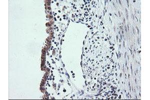 Image no. 2 for anti-V-Ets Erythroblastosis Virus E26 Oncogene Homolog 2 (ETS2) (AA 90-349) antibody (ABIN1491702)