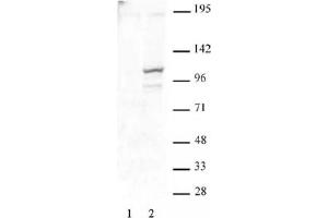 STAT2 phospho Tyr689 pAb tested by Western blot. (STAT2 anticorps  (pTyr689))