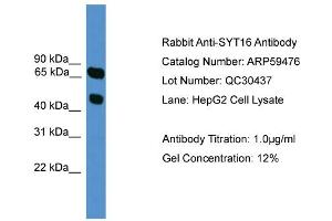 WB Suggested Anti-SYT16  Antibody Titration: 0. (SYT16 anticorps  (N-Term))