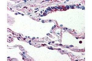 Immunohistochemistry (IHC) image for anti-Complement Component 5a Receptor 1 (C5AR1) antibody (ABIN2470782)