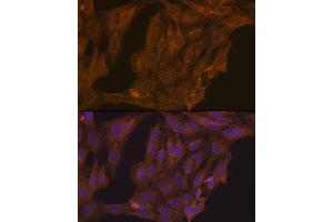 Immunofluorescence analysis of C6 cells using RARα Rabbit pAb (ABIN6128615, ABIN6146692, ABIN6146695 and ABIN6213825) at dilution of 1:100 (40x lens).