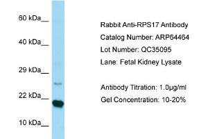 Western Blotting (WB) image for anti-Ribosomal Protein S17 (RPS17) (C-Term) antibody (ABIN2789846) (RPS17 anticorps  (C-Term))