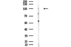 anti-Catenin (Cadherin-Associated Protein), alpha 2 (CTNNA2) (C-Term) antibody
