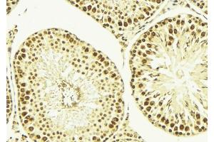ABIN6269183 at 1/100 staining Mouse testis tissue by IHC-P. (ELK1 anticorps  (C-Term))