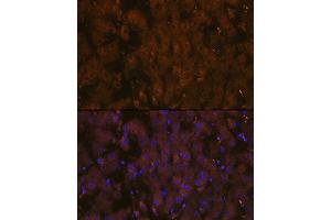 Immunofluorescence analysis of rat liver using MSP/MST1 Rabbit mAb (ABIN1680891, ABIN1680890, ABIN3015057 and ABIN3015058) at dilution of 1:100 (40x lens).