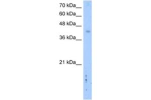 Western Blotting (WB) image for anti-Leucine Rich Repeat Containing 2 (LRRC2) antibody (ABIN2462610) (LRRC2 anticorps)