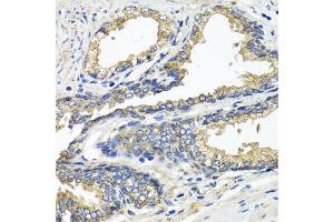 Immunohistochemistry of paraffin-embedded human prostate using ETFA antibody (ABIN5975750) at dilution of 1/100 (40x lens). (ETFA anticorps)