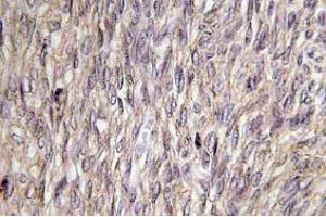 Image no. 2 for anti-Fibroblast Growth Factor 22 (FGF22) antibody (ABIN317810) (FGF22 anticorps)