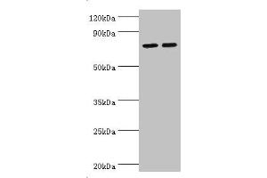 Western blot All lanes: Arachidonate 15-lipoxygenase B antibody at 11 μg/mL Lane 1: MCF-7 whole cell lysate Lane 2: 293T whole cell lysate Secondary Goat polyclonal to rabbit IgG at 1/10000 dilution Predicted band size: 76, 68, 70, 73 kDa Observed band size: 76 kDa (ALOX15B anticorps  (AA 1-200))