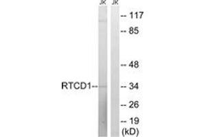 Western blot analysis of extracts from Jurkat cells, using RTCD1 Antibody. (RTCD1 anticorps  (AA 317-366))