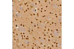 Immunohistochemistry of paraffin-embedded mouse brain using C Rabbit pAb (ABIN6130035, ABIN6137891, ABIN6137892 and ABIN6220925) at dilution of 1:100 (40x lens).