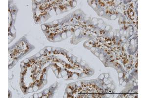 Immunoperoxidase of monoclonal antibody to PIP5K2A on formalin-fixed paraffin-embedded human small Intestine.