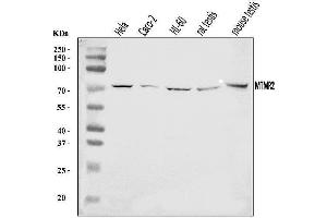 Western blot analysis of MTMR2 using anti-MTMR2 antibody (ABIN7603228).