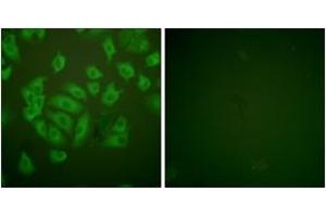 Immunofluorescence analysis of A549 cells, using Stefin A Antibody. (CSTA anticorps  (AA 49-98))