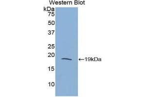 Detection of Recombinant RNASE3, Rat using Polyclonal Antibody to Ribonuclease A3 (RNASE3)