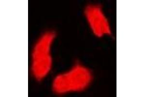 Immunofluorescent analysis of PSMB9 staining in MCF7 cells. (PSMB9 anticorps)