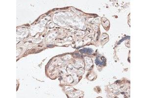 Immunohistochemistry of paraffin-embedded Human placenta using SPDEF Polyclonal Antibody at dilution of 1:100 (40x lens).