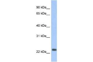 ND6 antibody used at 1 ug/ml to detect target protein.