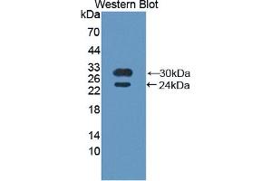 Western blot analysis of recombinant Human BMX. (BMX anticorps  (AA 287-523))