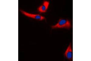 Immunofluorescent analysis of EPS8L3 staining in U251MG cells. (EPS8-Like 3 anticorps  (Center))