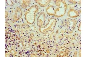 Immunohistochemistry of paraffin-embedded human kidney tissue using ABIN7150218 at dilution of 1:100 (ALKBH2 anticorps  (AA 1-261))