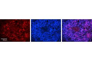 Rabbit Anti-PAntibody   Formalin Fixed Paraffin Embedded Tissue: Human Lymph Node Tissue Observed Staining: Nucleus Primary Antibody Concentration: 1:100 Other Working Concentrations: N/A Secondary Antibody: Donkey anti-Rabbit-Cy3 Secondary Antibody Concentration: 1:200 Magnification: 20X Exposure Time: 0.