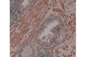 IHC-P analysis of Human Prostate Gland Tissue, with DAB staining.