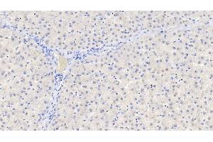 Detection of GDNF in Human Liver Tissue using Polyclonal Antibody to Glial Cell Line Derived Neurotrophic Factor (GDNF) (GDNF anticorps  (AA 78-211))