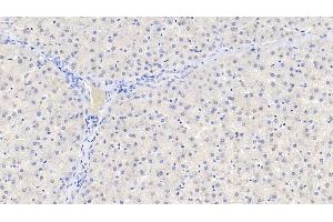 anti-Glial Cell Line Derived Neurotrophic Factor (GDNF) (AA 78-211) antibody
