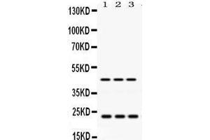 Western Blotting (WB) image for anti-RAB13, Member RAS Oncogene Family (RAB13) (AA 121-150), (C-Term) antibody (ABIN3043916) (RAB13 anticorps  (C-Term))
