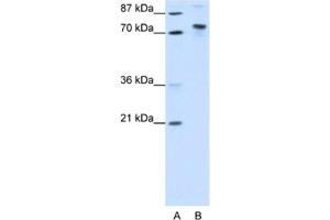 Western Blotting (WB) image for anti-TOX High Mobility Group Box Family Member 4 (TOX4) antibody (ABIN2461858) (TOX4 anticorps)