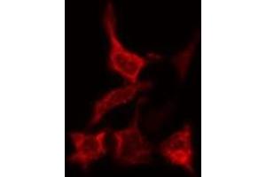 ABIN6277758 staining Hela cells by IF/ICC. (Catalase anticorps)