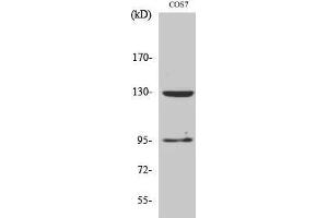 Western Blotting (WB) image for anti-gamma-aminobutyric Acid (GABA) B Receptor, 1 (GABBR1) (C-Term) antibody (ABIN3184723) (GABBR1 anticorps  (C-Term))