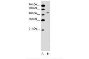 Image no. 2 for anti-Solute Carrier Family 12 (Sodium/potassium/chloride Transporters), Member 1 (SLC12A1) (AA 351-400) antibody (ABIN6736611) (SLC12A1 anticorps  (AA 351-400))
